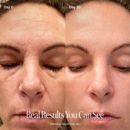 Radiant Renewal 4-in-1 Skincare Wand Kit