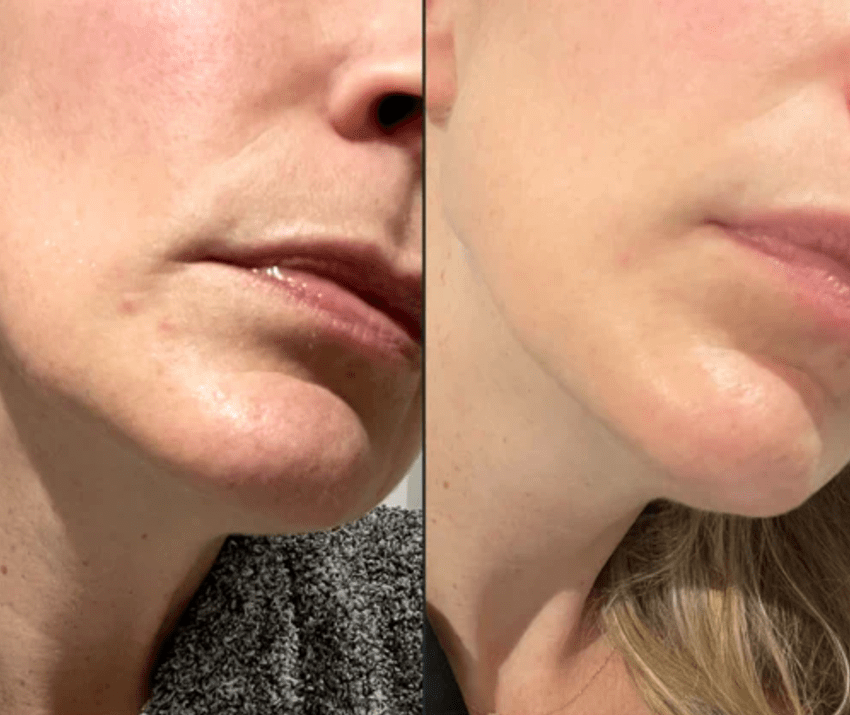 Radiant Renewal 4-in-1 Skincare Wand Kit