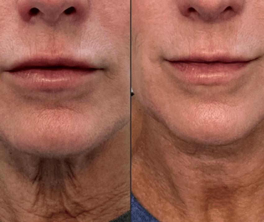 Radiant Renewal 4-in-1 Skincare Wand Kit