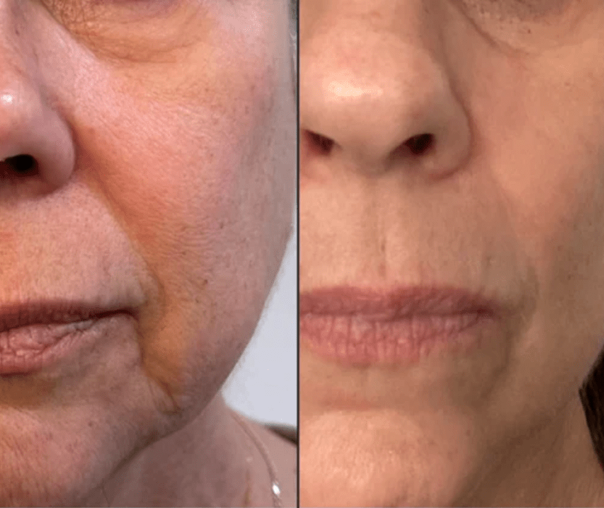 Radiant Renewal 4-in-1 Skincare Wand Kit