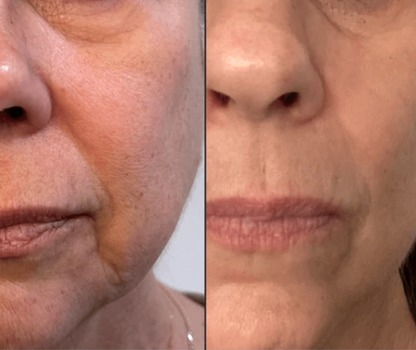 Radiant Renewal 4-in-1 Skincare Wand Kit